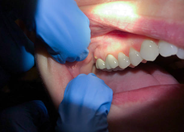 Best Emergency Cosmetic Dentistry in Stanley, NC